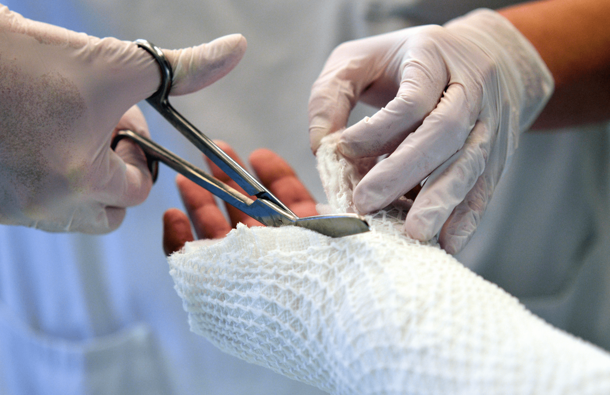 How Tight Should a Cast Be On Your Wrist?